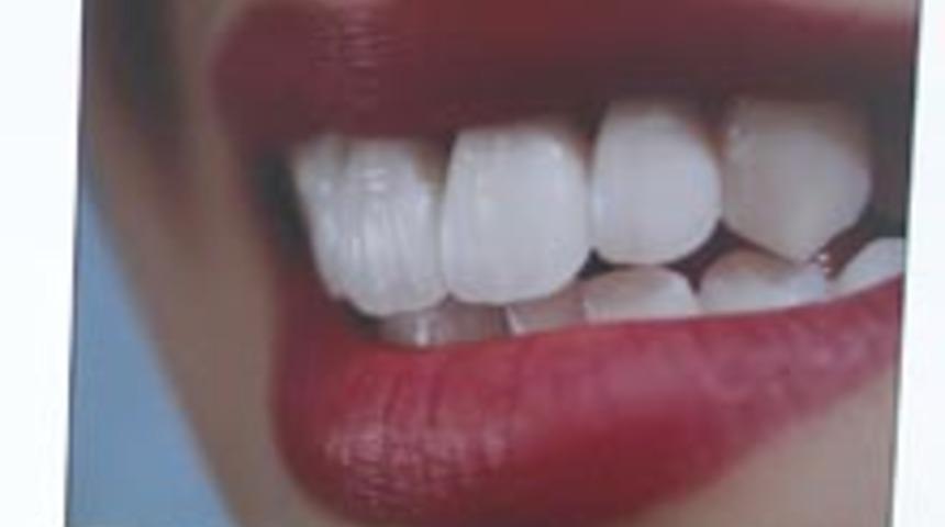 Diş Kusurlarınız Yok Oluyor