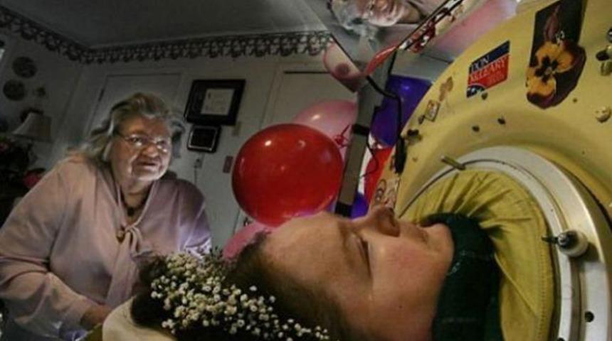 61 yıldır cihaza bağlı yaşıyor