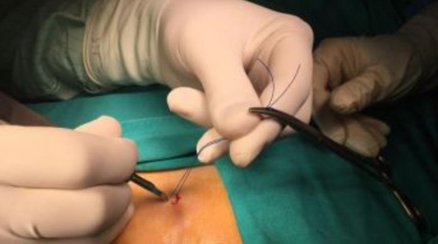 Oturarak &Ccedil;alışanlarda Kıl D&ouml;nmesi Riski Daha Fazla