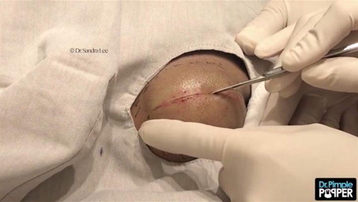 Kafasından çıkanlar şaşırttı  G4