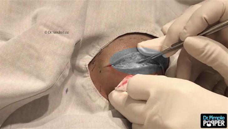 Kafasından çıkanlar şaşırttı  G5