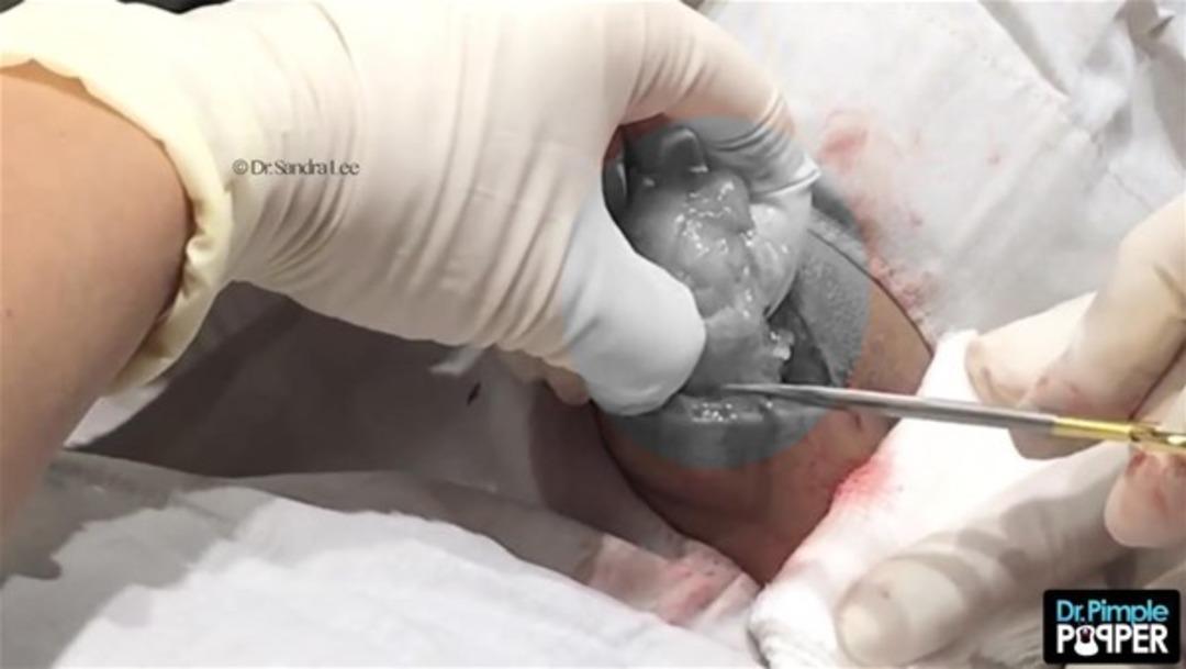 Kafasından &ccedil;ıkanlar şaşırttı 