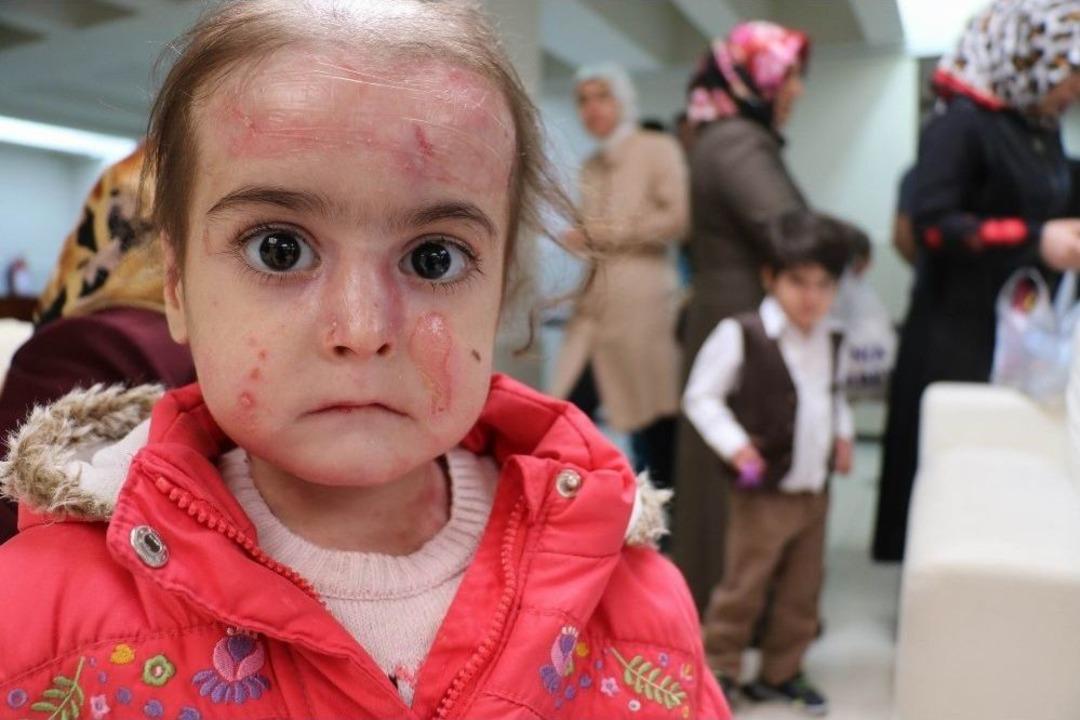 Kelebek &Ccedil;ocuklardan Doktorlarına Teşekk&uuml;r