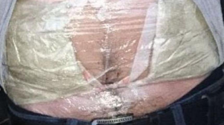 Yolcunun Karnına Sarılı Uyuşturucuyu Polis Buldu