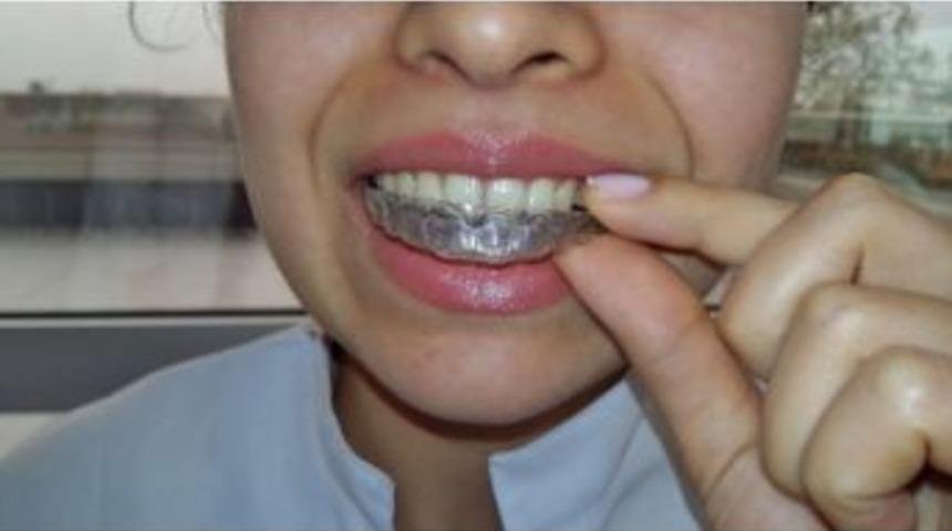 Estetiği Bozmadan Sağlıklı G&uuml;l&uuml;şler Artık Daha Kolay