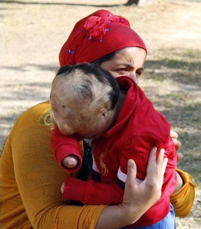 Yangın Kurbanı Minik Serkan’ın Son Umudu Antalya