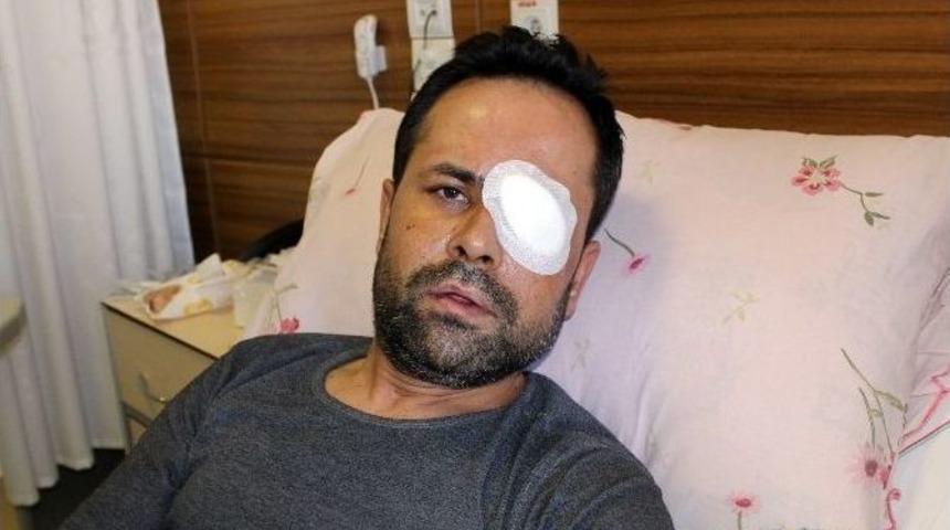 (özel Haber) Servisi Beğenmeyen Müşteri Garsonu Gözünden Etti