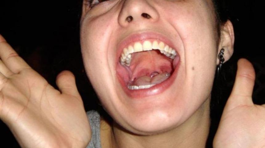 Bademcikle ilgili en &ouml;nemli 10 soru