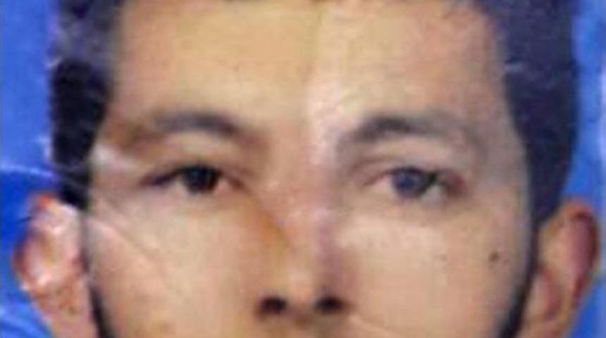 &Ouml;pmek Isteyince Bı&ccedil;aklayıp, Kanını Yaladı