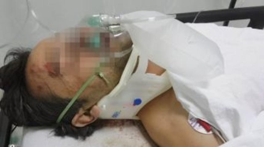 Darp Edilen İnşaat İş&ccedil;isi Ağır Yaralandı