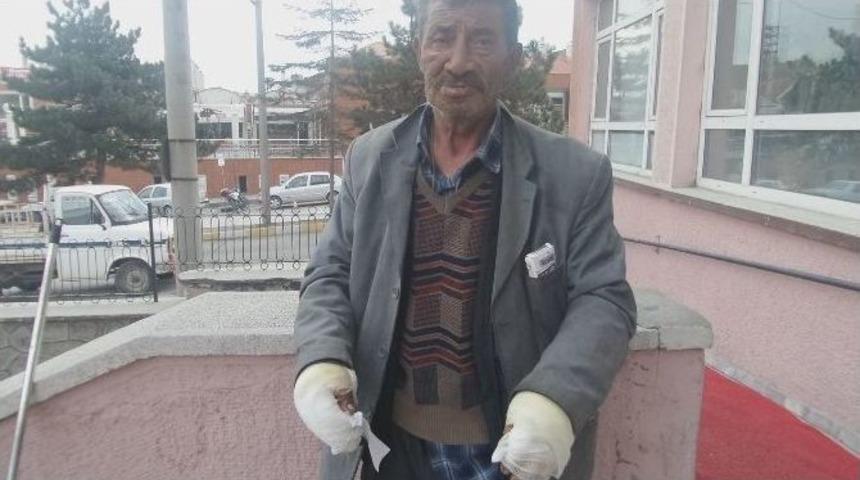 Su Yerine Benzinle Sobayı S&ouml;nd&uuml;r&uuml;nce &Ouml;l&uuml;mden D&ouml;nd&uuml;