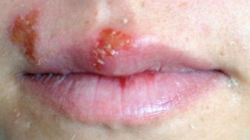 U&ccedil;uk Olan B&ouml;lgeye Dokunmayın