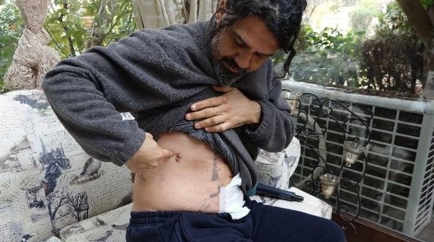 Bı&ccedil;aklandığı Anı Kameraya &Ccedil;ekti