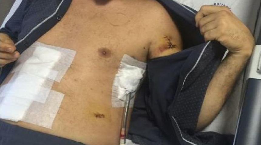 Bı&ccedil;aklanma Anını Kamerayla G&ouml;r&uuml;nt&uuml;ledi