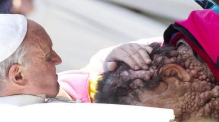 Papa&rsquo;nın &ouml;pt&uuml;ğ&uuml; t&uuml;m&ouml;rl&uuml; adam o anları anlattı