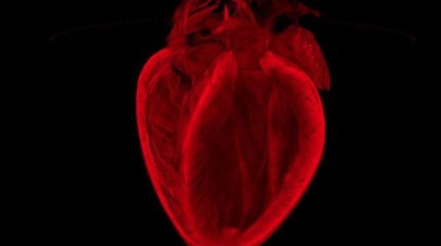 Kalbinizi hi&ccedil; b&ouml;yle g&ouml;rmediniz