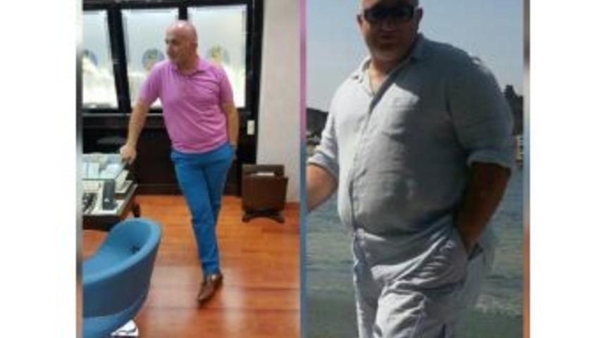 Obezite Hastaları Antalya&rsquo;da Buluşuyor