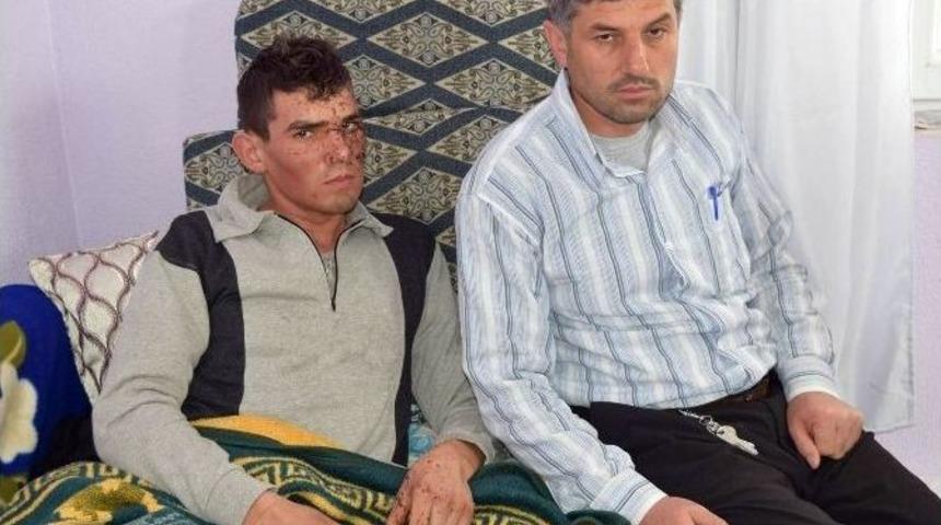 Kayseri Patlamasında Yaralanan Asker Arif &Ouml;zkara Dehşeti Anlattı