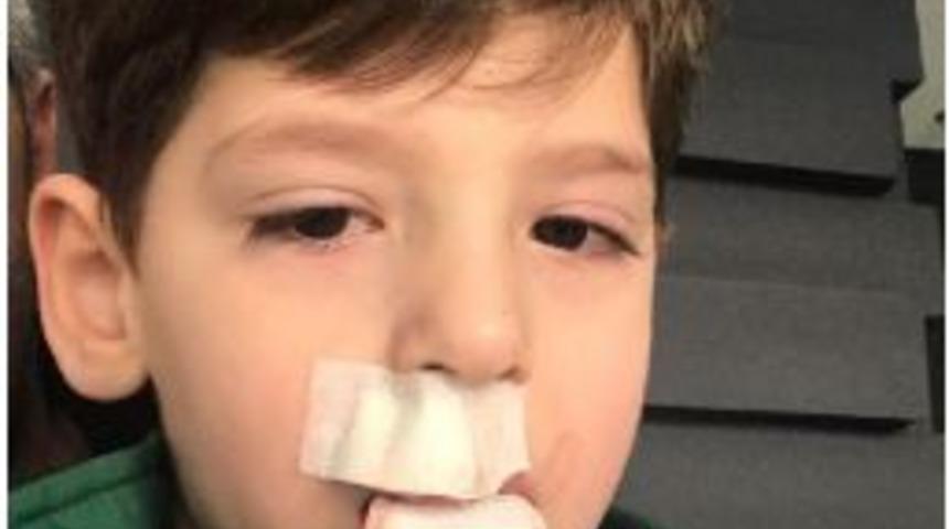 Anaokulunda Oynarken Arkadaşı Itince Dişleri Kırıldı