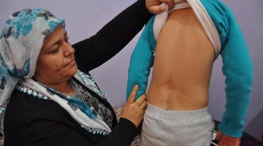 Kızlarının Ameliyatı I&ccedil;in Evlerini Satılığa &Ccedil;ıkardılar