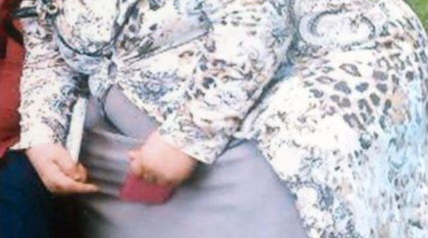 Robotik Cerrahi Ile 75 Kilo Verdi, 2. Bebek Hasreti Sona Erdi