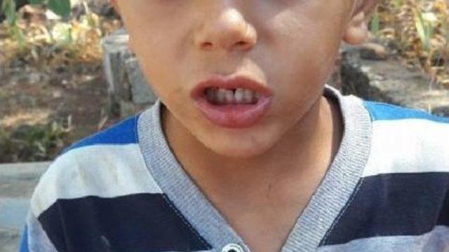 İğneden Sonra Ölen Minik Yalçın'da 'anafilaksi' Gelişmiş