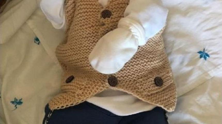 İki Haftalık Bebeğin Y&uuml;z&uuml;ndeki Kitle Operasyonla Alındı