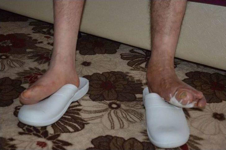 Tıp, Aydınalp Kardeşlerin Hastalığına İsim Koyamadı G5