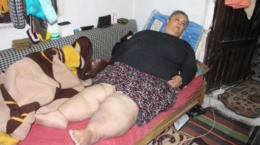 Fethiye&rsquo;de Fil Hastası Kadının Dramı Y&uuml;rek Burkuyor