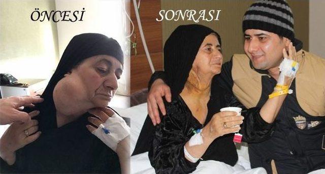 30 Yıl Boyunca Boynunda 1 Kilo Tömör İle Yaşadı