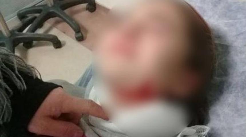 Köpeklerin Saldırısına Uğrayan Çocuk Ölümden Döndü