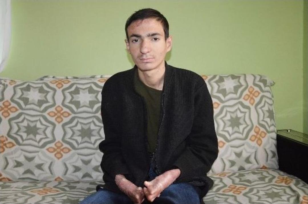 Kelebek Hastası Gencin Tek İsteği Kalem Tutabilmek