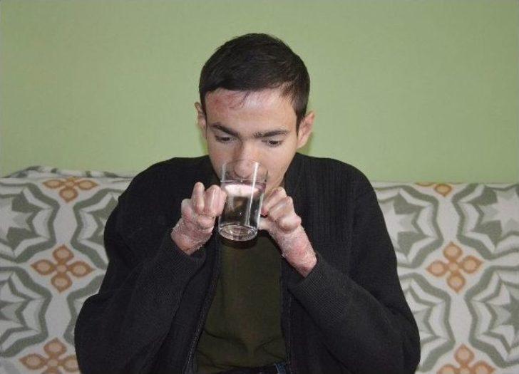 Kelebek Hastası Gencin Tek İsteği Kalem Tutabilmek G2