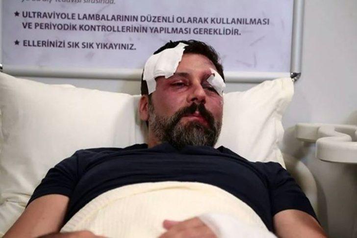 Diğer Yarım 12. Bölüm Galerisi G4