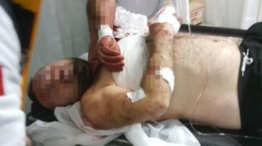 Samsun&rsquo;da Bı&ccedil;aklı Saldırı: 2 Yaralı