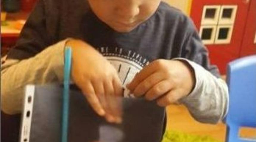 &Ccedil;&ouml;ken Bina 5 Yaşındaki İkizleri Ayırdı