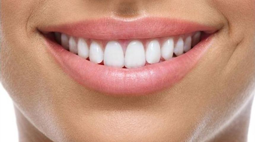 (&ouml;zel Haber) 14 Şubat &Ouml;ncesi &Ccedil;iftlerde Diş Bakımı Telaşı