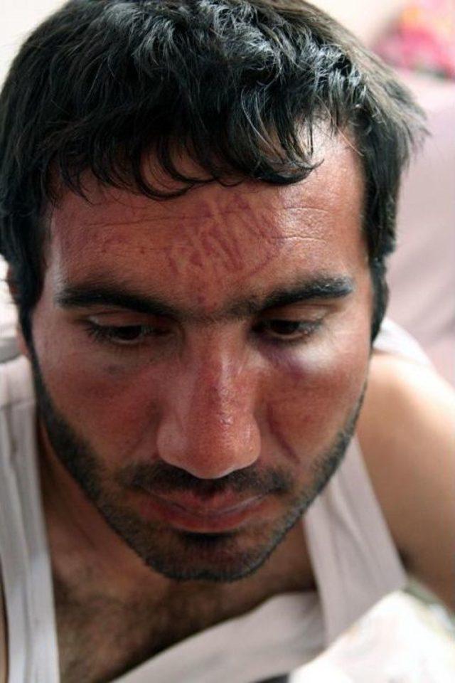 Alında Bot Izi &Ccedil;ıkartan Polis Dayağına Yargıtay Ayarı: İşkence Olabilir 1