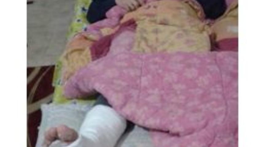 Başkan Bakırlıoğlu Karda Kayıp D&uuml;ş&uuml;nce Ayak Bileğinin 3 Yerinde &Ccedil;atlak Oluştu