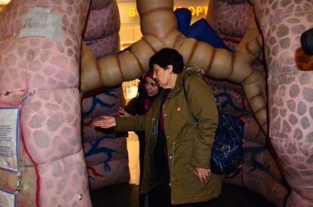 3 Metrelik Maket Akciğerle Sigaranın Zararlarına Dikkat &Ccedil;ektiler 3