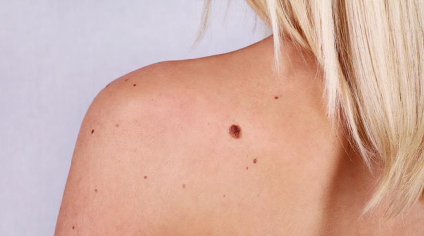 V&uuml;cudunuzdaki ben tehlikeli mi değil mi nasıl anlaşılır? 