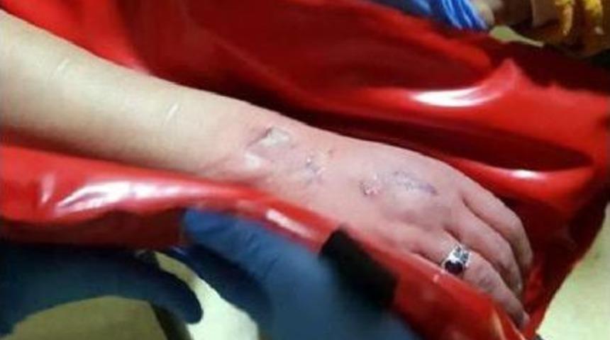 Asans&ouml;re Elini Sıkıştıran Genci, Itfaiye Kurtardı