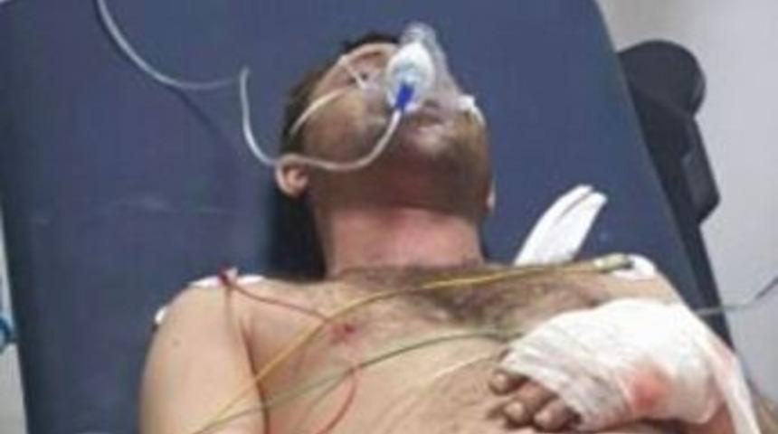 Samsun&rsquo;da T&uuml;p Patladı: 1 Yaralı