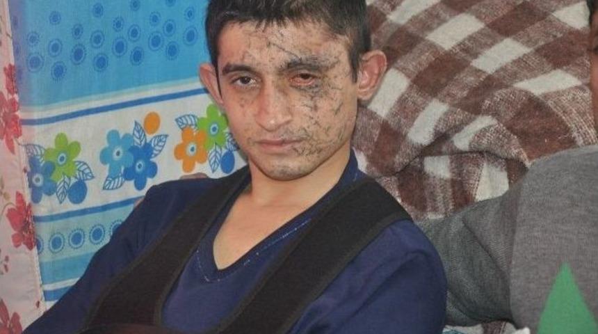 (&ouml;zel Haber) Kayseri Patlaması Gazisi Evine D&ouml;nd&uuml;