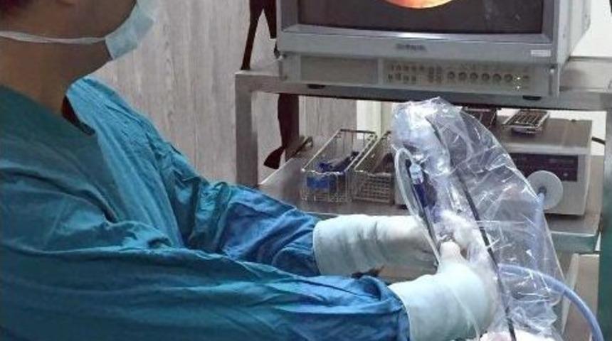 &Ouml;staki Borusu Tıkanıklığı Balon Y&ouml;ntemiyle Aşılıyor