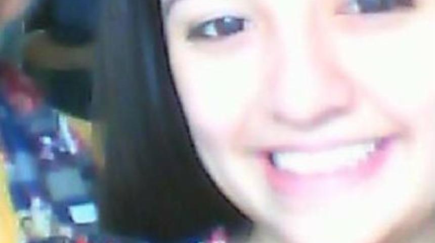 Burun Ameliyatında Beyin Kanaması Ge&ccedil;iren K&uuml;bra &Ouml;ld&uuml; (2)