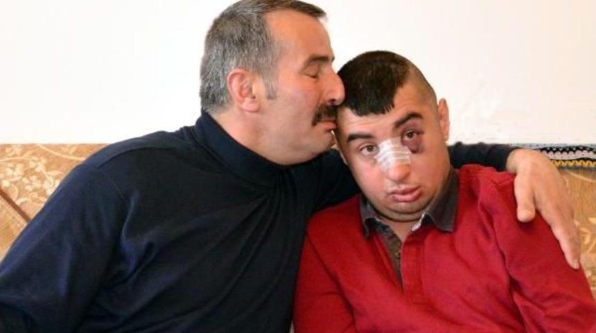 Zihinsel Engelli Genci D&ouml;ven Serbest Bırakıldı