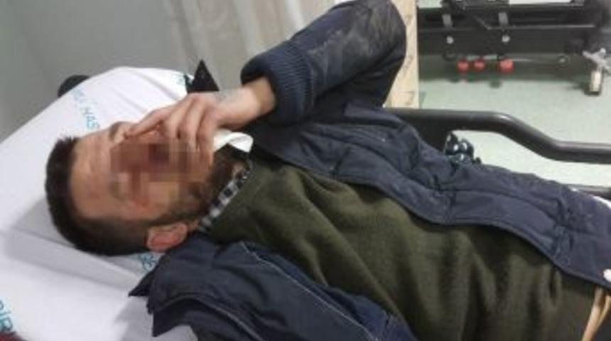 Asker Eğlencesinde Hastanelik Oldu