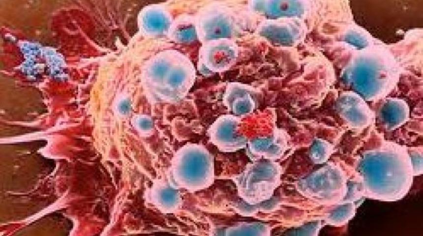 İşte kanserin 10 belirtisi