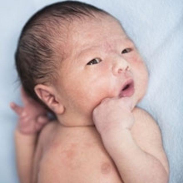 Doğum Y&ouml;ntemleri 1